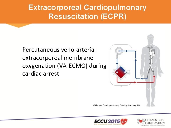 Extracorporeal Cardiopulmonary Resuscitation (ECPR) Percutaneous veno-arterial extracorporeal membrane oxygenation (VA-ECMO) during cardiac arrest 