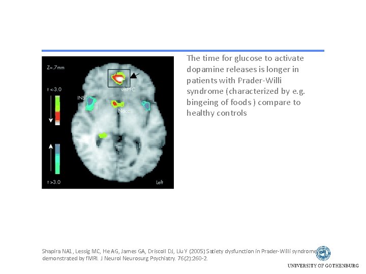 The time for glucose to activate dopamine releases is longer in patients with Prader-Willi