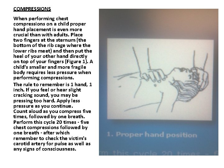 COMPRESSIONS When performing chest compressions on a child proper hand placement is even more