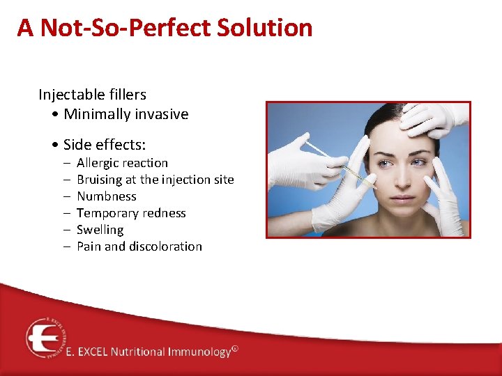 A Not-So-Perfect Solution Injectable fillers • Minimally invasive • Side effects: – – –