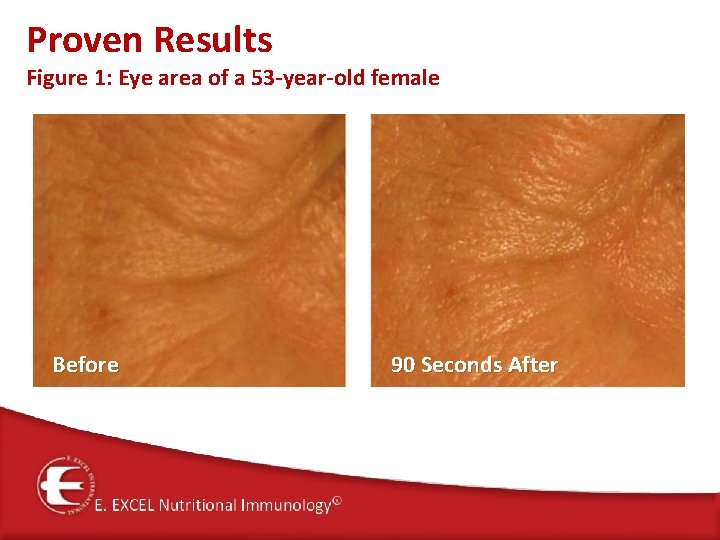 Proven Results Figure 1: Eye area of a 53 -year-old female Before 90 Seconds