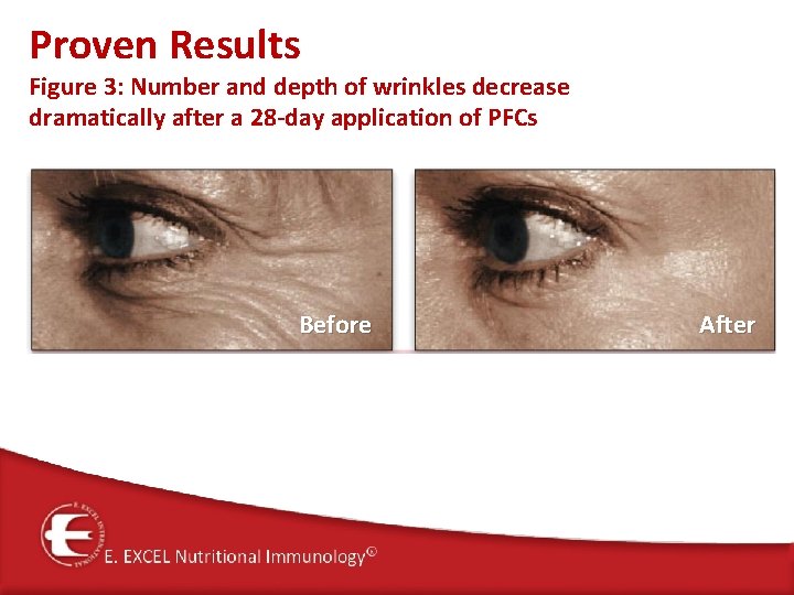 Proven Results Figure 3: Number and depth of wrinkles decrease dramatically after a 28