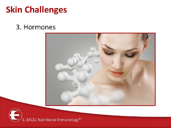 Skin Challenges 3. Hormones 