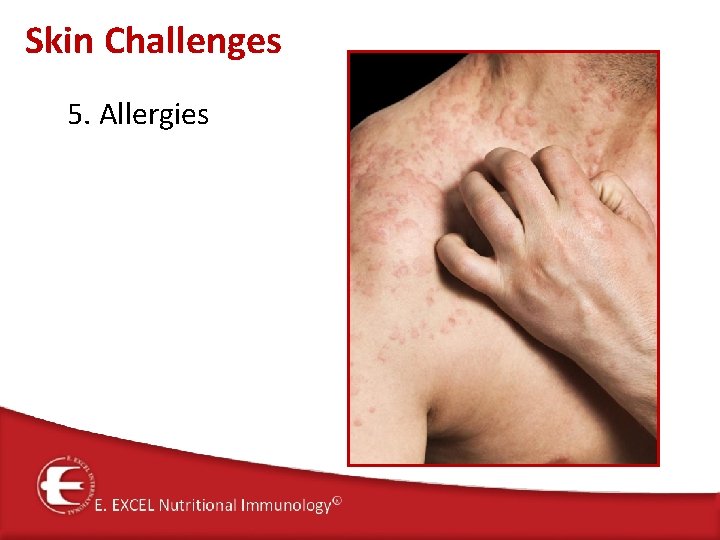 Skin Challenges 5. Allergies 