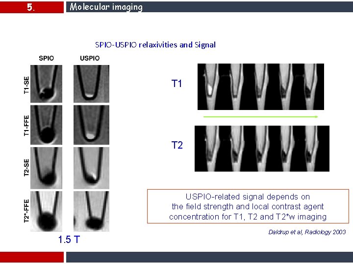 5. Molecular imaging SPIO-USPIO relaxivities and Signal Incubated cells with USPIO T 1 [C]