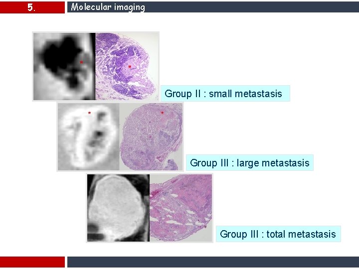 5. Molecular imaging Ex vivo Group II : small metastasis Group III : large