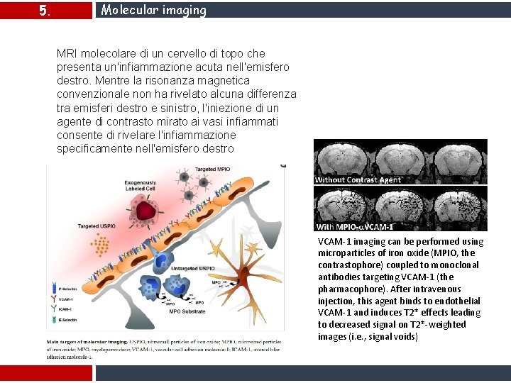 5. Molecular imaging MRI molecolare di un cervello di topo che presenta un'infiammazione acuta