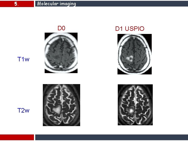 5. Molecular imaging D 0 T 1 w T 2 w D 1 USPIO