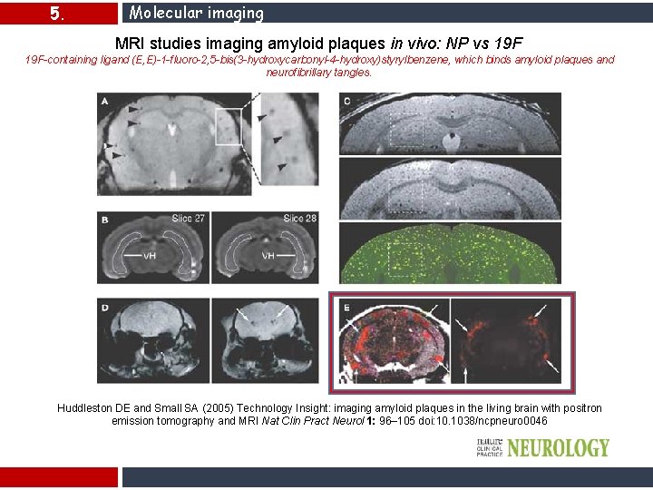 5. Molecular imaging MRI studies imaging amyloid plaques in vivo: NP vs 19 F-containing