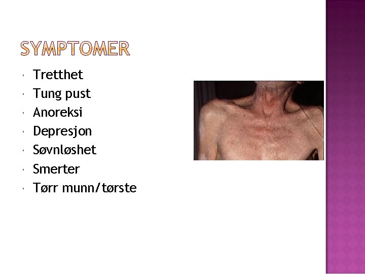 Tretthet Tung pust Anoreksi Depresjon Søvnløshet Smerter Tørr munn/tørste 