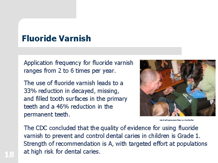 Fluoride Varnish Application frequency for fluoride varnish ranges from 2 to 6 times per Fluoride Varnish Application frequency for fluoride varnish ranges from 2 to 6 times per