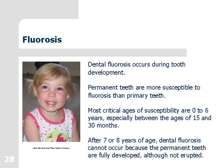Fluorosis Dental fluorosis occurs during tooth development. Permanent teeth are more susceptible to fluorosis Fluorosis Dental fluorosis occurs during tooth development. Permanent teeth are more susceptible to fluorosis
