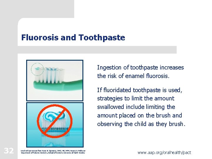 Fluorosis and Toothpaste Ingestion of toothpaste increases the risk of enamel fluorosis. If fluoridated Fluorosis and Toothpaste Ingestion of toothpaste increases the risk of enamel fluorosis. If fluoridated
