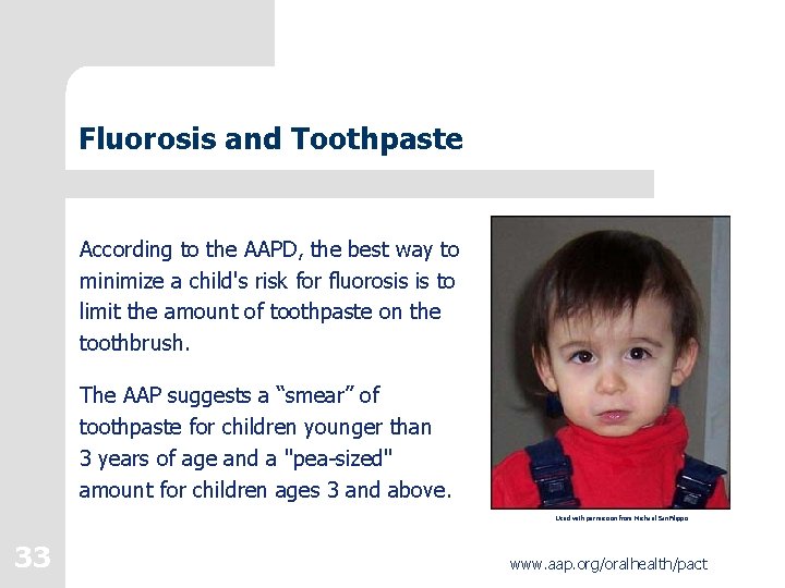 Fluorosis and Toothpaste According to the AAPD, the best way to minimize a child's Fluorosis and Toothpaste According to the AAPD, the best way to minimize a child's