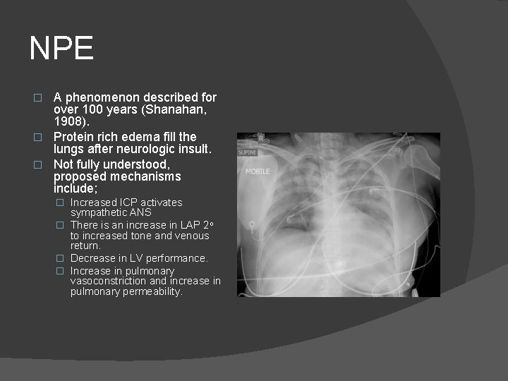 NPE A phenomenon described for over 100 years (Shanahan, 1908). � Protein rich edema NPE A phenomenon described for over 100 years (Shanahan, 1908). � Protein rich edema