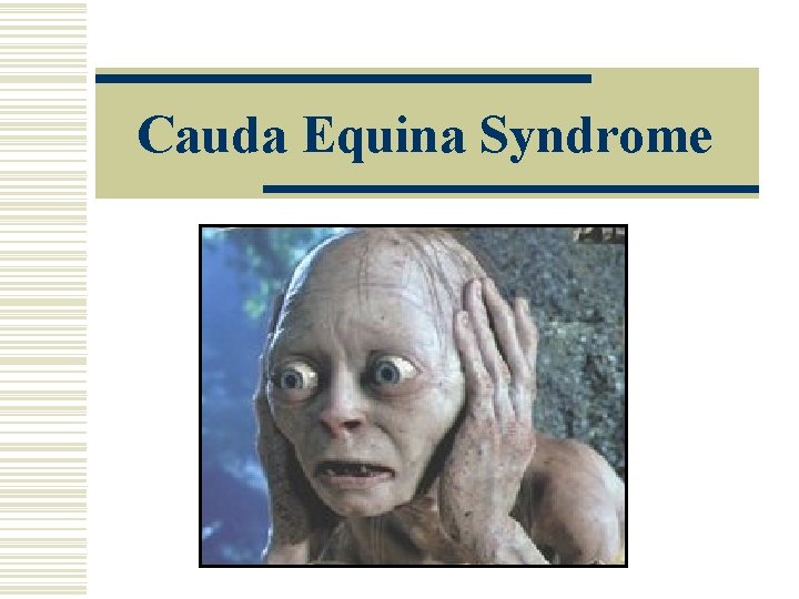 Cauda Equina Syndrome 