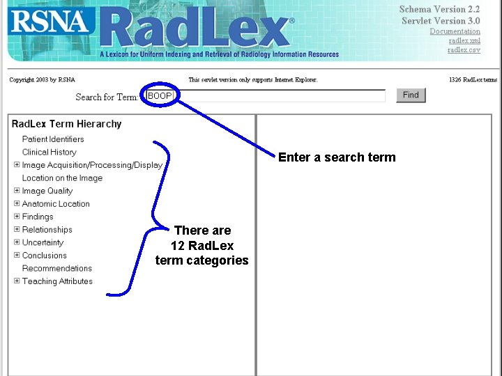 Opening Screen Enter a search term There are 12 Rad. Lex term categories 