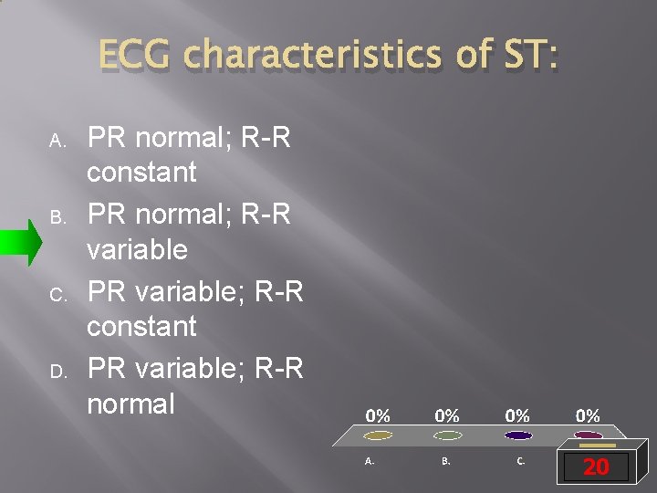 ECG characteristics of ST: A. B. C. D. PR normal; R-R constant PR normal;