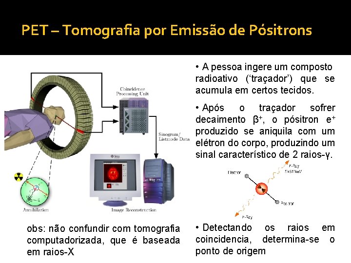 PET – Tomografia por Emissão de Pósitrons • A pessoa ingere um composto radioativo