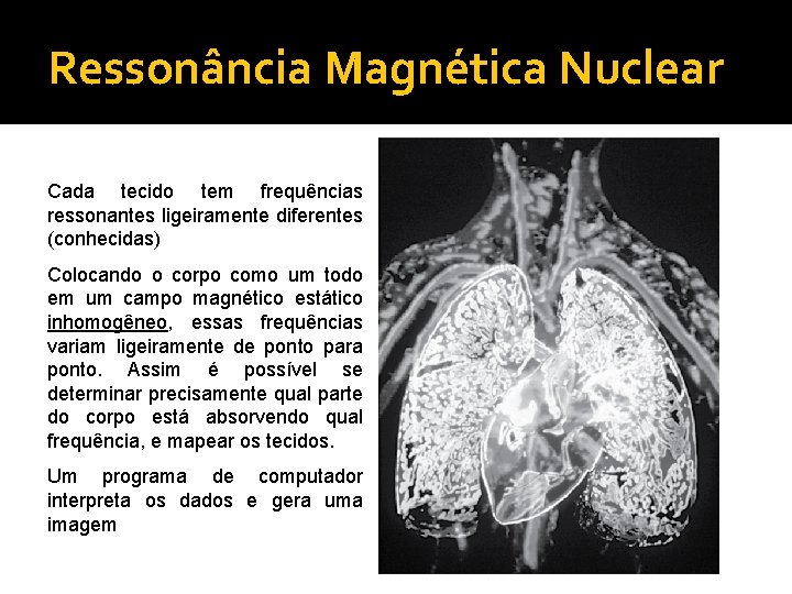 Ressonância Magnética Nuclear Cada tecido tem frequências ressonantes ligeiramente diferentes (conhecidas) Colocando o corpo