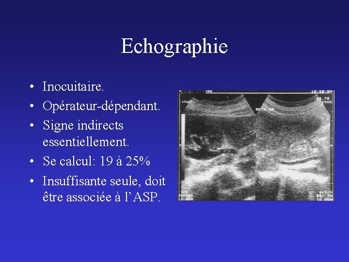 Echographie • Inocuitaire. • Opérateur-dépendant. • Signe indirects essentiellement. • Se calcul: 19 à