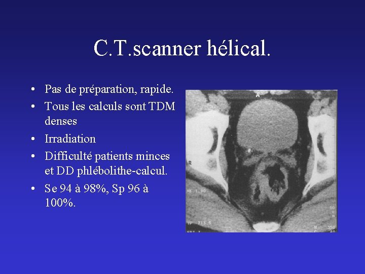 C. T. scanner hélical. • Pas de préparation, rapide. • Tous les calculs sont