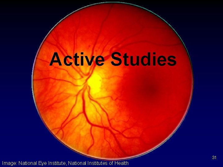 Active Studies 31 Image: National Eye Institute, National Institutes of Health 