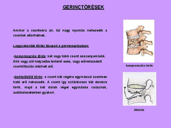 GERINCTÖRÉSEK Amikor a csontokra ún. túl nagy nyomás nehezedik a csontok eltörhetnek. Leggyakoribb törési