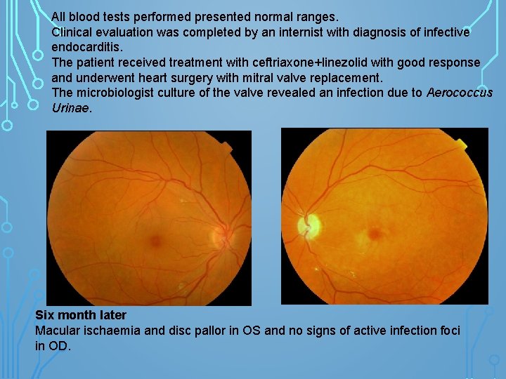 All blood tests performed presented normal ranges. Clinical evaluation was completed by an internist