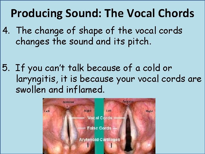 Producing Sound: The Vocal Chords 4. The change of shape of the vocal cords Producing Sound: The Vocal Chords 4. The change of shape of the vocal cords
