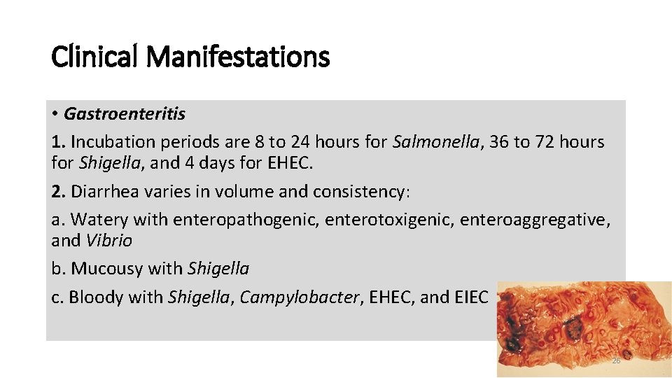 Clinical Manifestations • Gastroenteritis 1. Incubation periods are 8 to 24 hours for Salmonella,