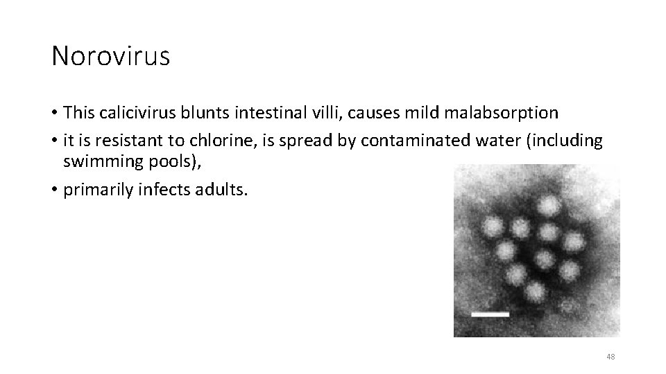 Norovirus • This calicivirus blunts intestinal villi, causes mild malabsorption • it is resistant