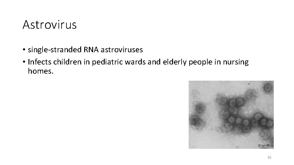 Astrovirus • single-stranded RNA astroviruses • Infects children in pediatric wards and elderly people