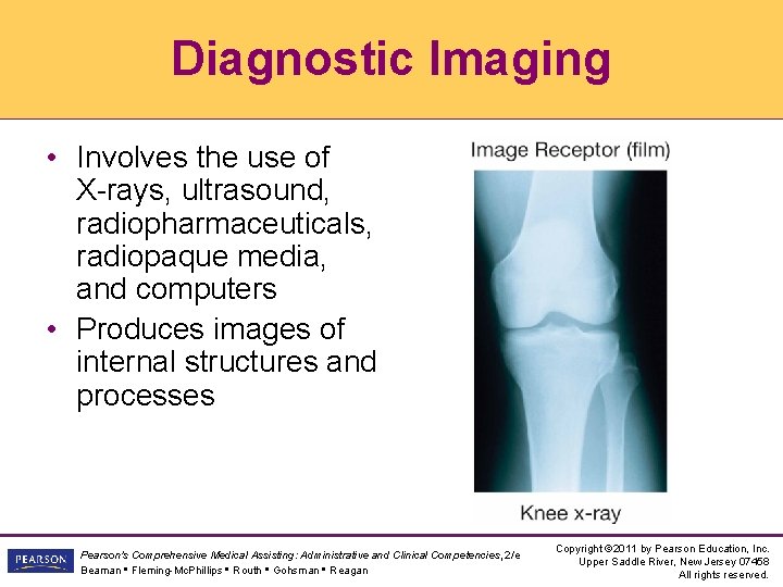 Diagnostic Imaging • Involves the use of X-rays, ultrasound, radiopharmaceuticals, radiopaque media, and computers