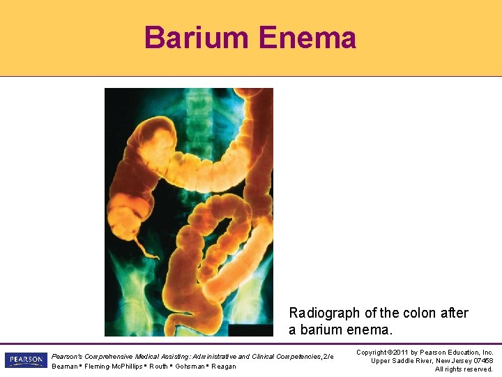 Barium Enema Radiograph of the colon after a barium enema. Pearson's Comprehensive Medical Assisting:
