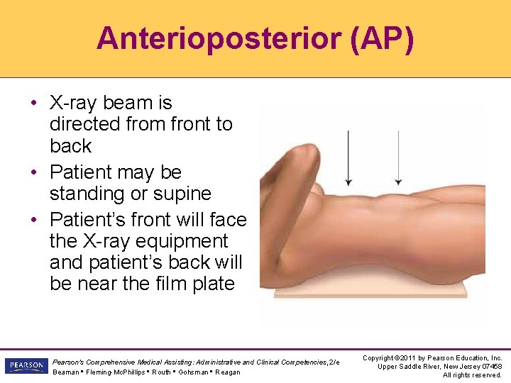 Anterioposterior (AP) • X-ray beam is directed from front to back • Patient may