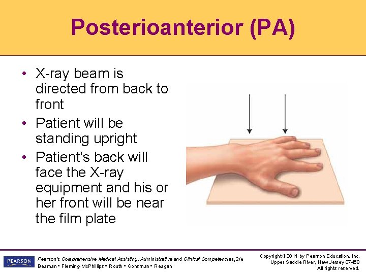 Posterioanterior (PA) • X-ray beam is directed from back to front • Patient will