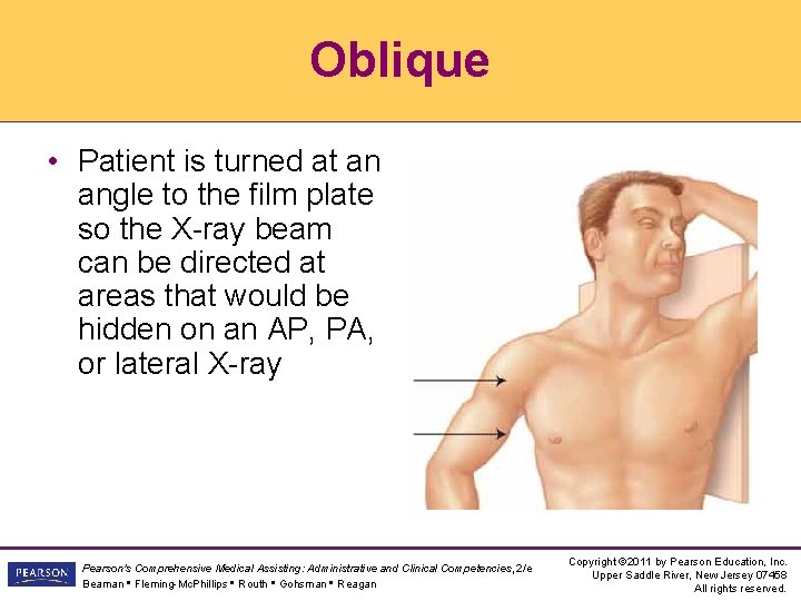 Oblique • Patient is turned at an angle to the film plate so the