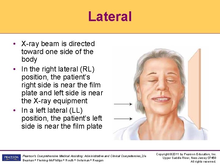 Lateral • X-ray beam is directed toward one side of the body • In