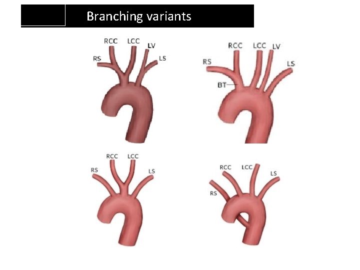 Branching variants Branching variants