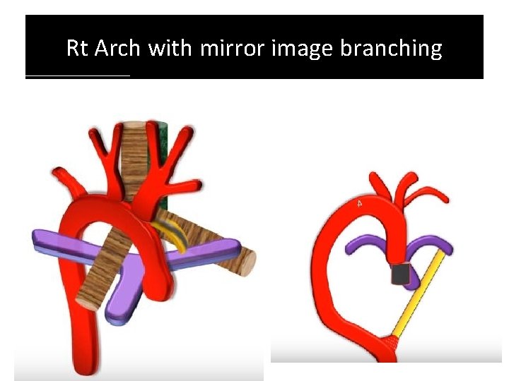 Rt Arch with mirror image branching Rt Arch with mirror image branching