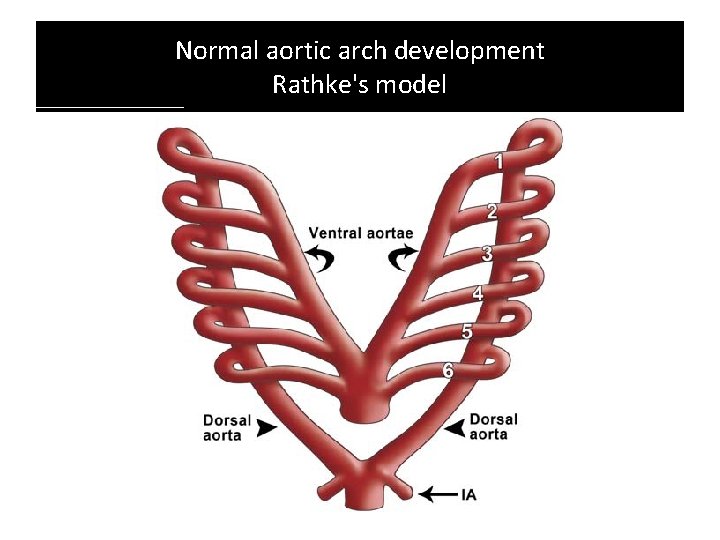 Normal aortic arch development Rathke's model Normal aortic arch development Rathke's model