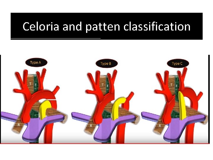 Celoria and patten classification Celoria and patten classification