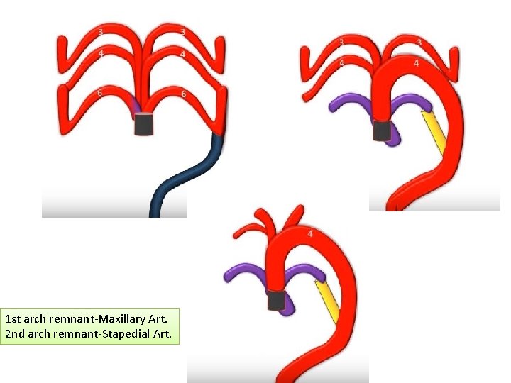 1 st arch remnant-Maxillary Art. 2 nd arch remnant-Stapedial Art. 1 st arch remnant-Maxillary Art. 2 nd arch remnant-Stapedial Art.