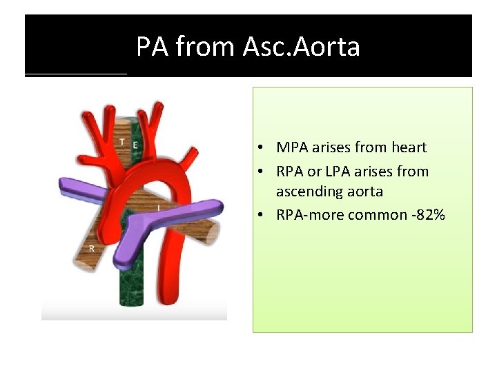 PA from Asc. Aorta • MPA arises from heart • RPA or LPA arises PA from Asc. Aorta • MPA arises from heart • RPA or LPA arises
