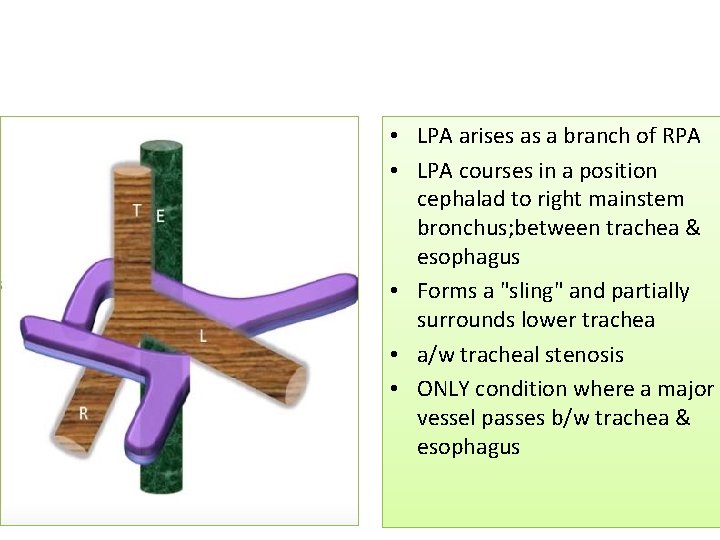 • LPA arises as a branch of RPA • LPA courses in a • LPA arises as a branch of RPA • LPA courses in a