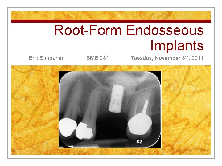 Root-Form Endosseous Implants Erik Simpanen BME 281 Tuesday, November 8 th, 2011 