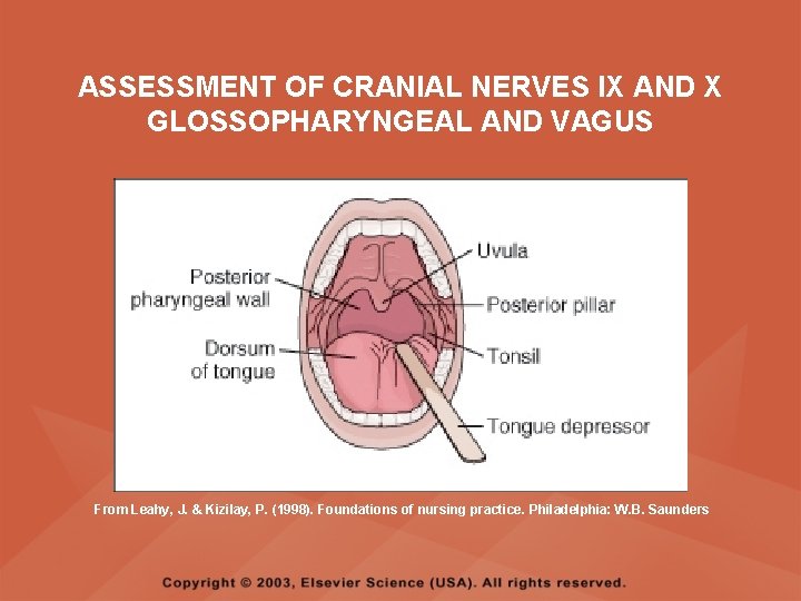 ASSESSMENT OF CRANIAL NERVES IX AND X GLOSSOPHARYNGEAL AND VAGUS From Leahy, J. & ASSESSMENT OF CRANIAL NERVES IX AND X GLOSSOPHARYNGEAL AND VAGUS From Leahy, J. &
