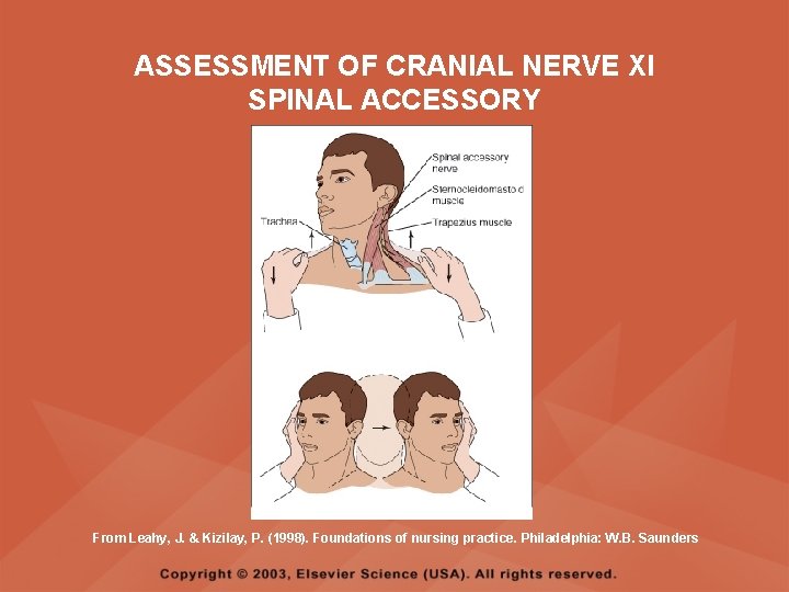 ASSESSMENT OF CRANIAL NERVE XI SPINAL ACCESSORY From Leahy, J. & Kizilay, P. (1998). ASSESSMENT OF CRANIAL NERVE XI SPINAL ACCESSORY From Leahy, J. & Kizilay, P. (1998).