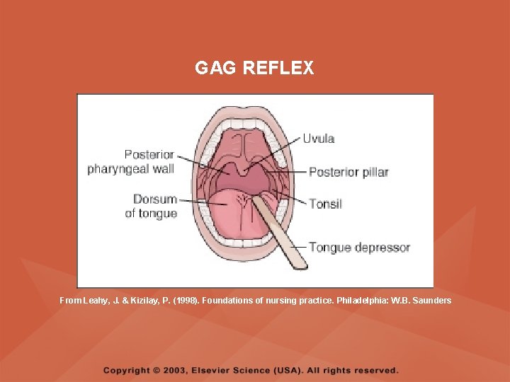 GAG REFLEX From Leahy, J. & Kizilay, P. (1998). Foundations of nursing practice. Philadelphia: GAG REFLEX From Leahy, J. & Kizilay, P. (1998). Foundations of nursing practice. Philadelphia:
